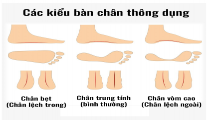 Chọn giày chạy bộ theo kiểu bàn chân