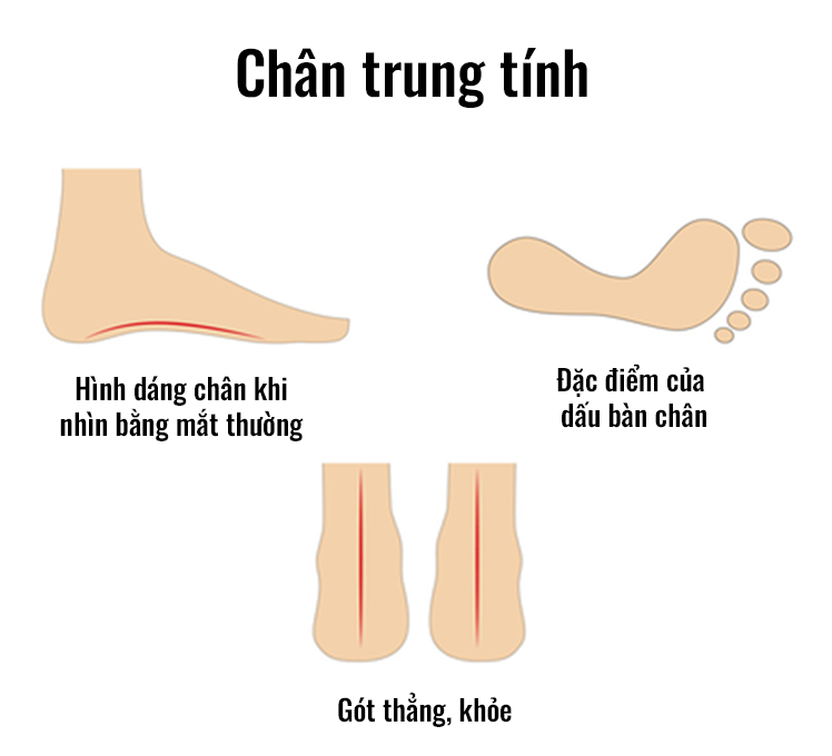 Chân vòm thấp